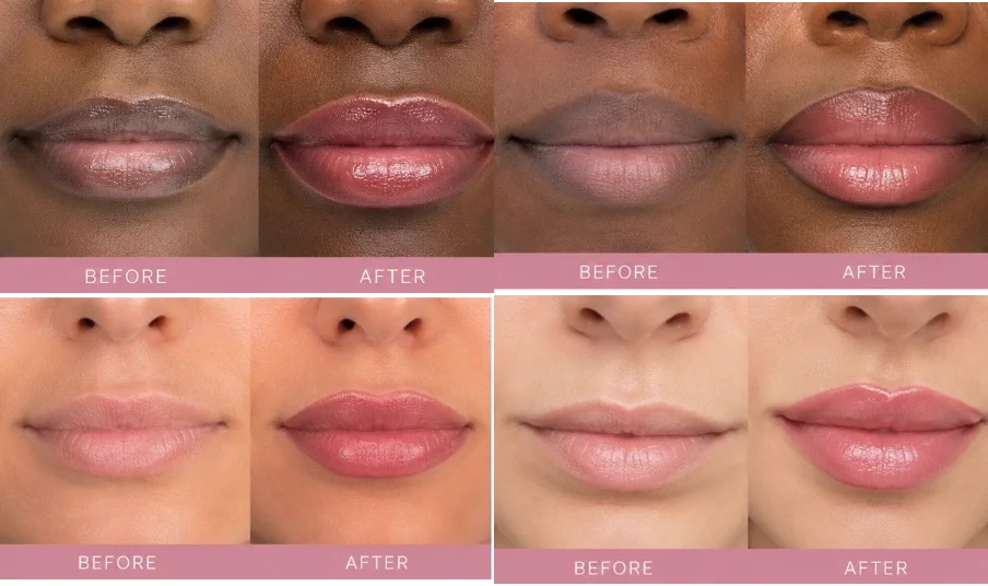 Four client-supplied lip-blush before-and-after examples